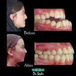مطب تخصصی ارتودنسی نامرئی و شفاف دکتر هومن صدرحقیقی در تبریز