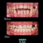 مطب تخصصی ارتودنسی نامرئی و شفاف دکتر هومن صدرحقیقی در تبریز