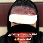 کلینیک تخصصی مو رسول زاده بحرینی در امیری آبادان