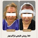 کلینیک تخصصی مو رسول زاده بحرینی در امیری آبادان