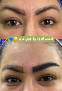 کلینیک تخصصی مو رسول زاده بحرینی در امیری آبادان