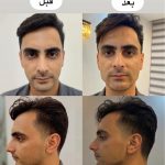 کلینیک زیبایی یوکابد در هاشمیه مشهد