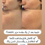 کلینیک زیبایی یوکابد در هاشمیه مشهد