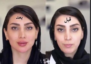 مشاهده کلینیک زیبایی یوکابد در هاشمیه مشهد در سامانه بهبود مشاغل