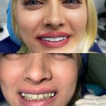 کلینیک فوق تخصصی دندانپزشکی فرتاک در آیت الله کاشانی تهران