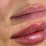 کلینیک زیبایی دکتر پریسا رشتچی در حسنی ارومیه