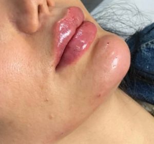 مشاهده کلینیک زیبایی دکتر پریسا رشتچی در حسنی ارومیه در سامانه بهبود مشاغل