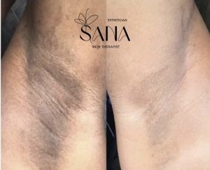 مشاهده خدمات درمانی پوست و هایفو SANA در شاهین ویلا کرج در سامانه بهبود مشاغل