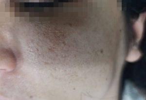 مشاهده کلینیک زیبایی شادی در بلوار ولیعصر دزفول در سامانه بهبود مشاغل
