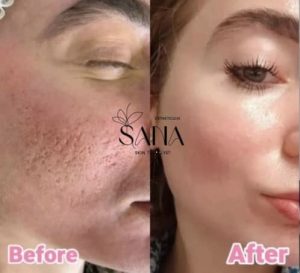 مشاهده خدمات درمانی پوست و هایفو SANA در شاهین ویلا کرج در سامانه بهبود مشاغل