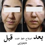 خدمات درمانی پوست و هایفو SANA در شاهین ویلا کرج
