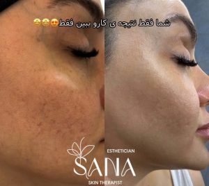 مشاهده خدمات درمانی پوست و هایفو SANA در شاهین ویلا کرج در سامانه بهبود مشاغل