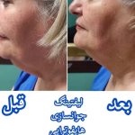 خدمات درمانی پوست و هایفو SANA در شاهین ویلا کرج