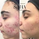 خدمات درمانی پوست و هایفو SANA در شاهین ویلا کرج