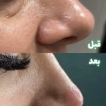 خدمات درمانی پوست و هایفو SANA در شاهین ویلا کرج