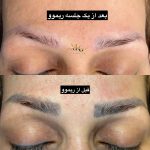 خدمات تخصصی آرایش دائم بیتا در میدان استقلال پرند