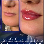 مطب زیبایی دکتر دینی در زعفرانیه تهران