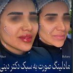 مطب زیبایی دکتر دینی در زعفرانیه تهران