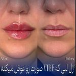 مطب زیبایی دکتر دینی در زعفرانیه تهران