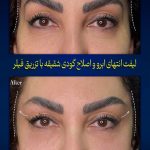 مطب زیبایی دکتر دینی در زعفرانیه تهران