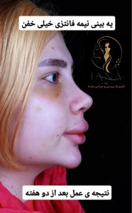 مشاهده مطب زیبایی جانا در احمدآباد مشهد در سامانه بهبود مشاغل