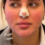 مرکز زیبایی پناه در ولیعصر تبریز