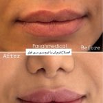 مرکز زیبایی پناه در ولیعصر تبریز