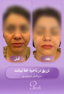 مشاهده مرکز زیبایی پناه در ولیعصر تبریز در سامانه بهبود مشاغل