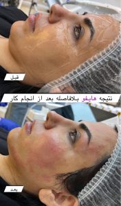 مشاهده مرکز زیبایی پناه در ولیعصر تبریز در سامانه بهبود مشاغل