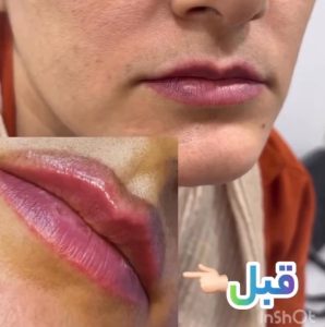 مشاهده کلینیک زیبایی همتا در کیانپارس اهواز در سامانه بهبود مشاغل