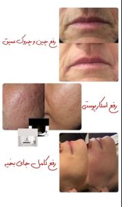 مشاهده مرکز جوانسازی پوست و مو بیوممتیک مهدیه بیوتی در نیاوران تهران در سامانه بهبود مشاغل