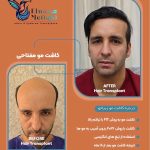 خدمات کاشت مو مفتاحی در خاکشناسی شیراز