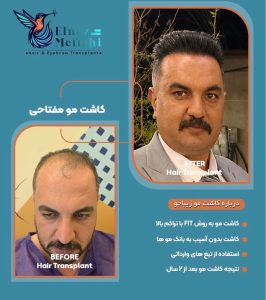 مشاهده خدمات کاشت مو مفتاحی در خاکشناسی شیراز در سامانه بهبود مشاغل