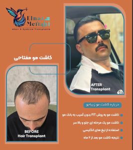 مشاهده خدمات کاشت مو مفتاحی در خاکشناسی شیراز در سامانه بهبود مشاغل