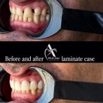 مطب دندانپزشکی دکتر علی علوی در بندرعباس