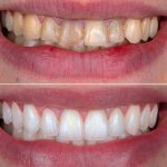 کلینیک دندانپزشکی آریا در آبیک