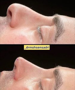 مشاهده مطب تخصصی زیبایی دکتر محسن صدری در ولیعصر تهران در سامانه بهبود مشاغل