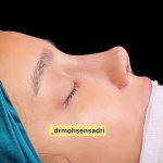 مطب تخصصی زیبایی دکتر محسن صدری در ولیعصر تهران