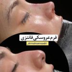 مطب تخصصی زیبایی دکتر محسن صدری در ولیعصر تهران