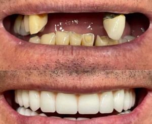 مشاهده مطب دندانپزشکی دکتر فاطمه شبانی در سردرود در سامانه بهبود مشاغل