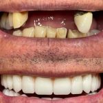 مطب دندانپزشکی دکتر منصور مسیبی در ستارخان تهران