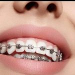 مطب دندانپزشکی دکتر فاطمه شبانی در سردرود