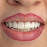 مطب دندانپزشکی دکتر یوسف جوادی در تبریز