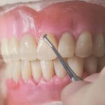 مطب دندانپزشکی دکتر یوسف جوادی در تبریز