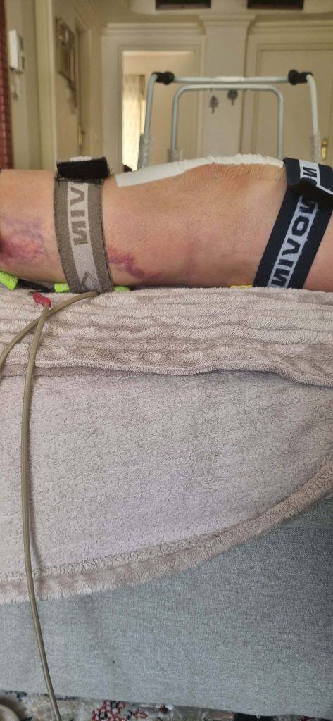 مشاهده خدمات فیزیوتراپی در منزل دکتر محمد سهرابی در رشت در سامانه بهبود مشاغل