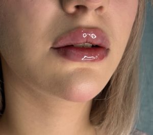 مشاهده مرکز تزریق فیلر بادی برنا در اصفهان در سامانه بهبود مشاغل