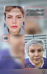 مشاهده جراح زیبایی و بلفاروپلاستی دکتر امیرعباس صفری پور در معالی آباد شیراز در سامانه بهبود مشاغل