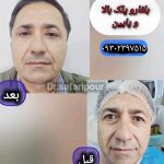جراح زیبایی و بلفاروپلاستی دکتر امیرعباس صفری پور در معالی آباد شیراز
