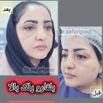 جراح زیبایی و بلفاروپلاستی دکتر امیرعباس صفری پور در معالی آباد شیراز