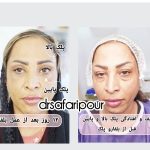 جراح زیبایی و بلفاروپلاستی دکتر امیرعباس صفری پور در معالی آباد شیراز
